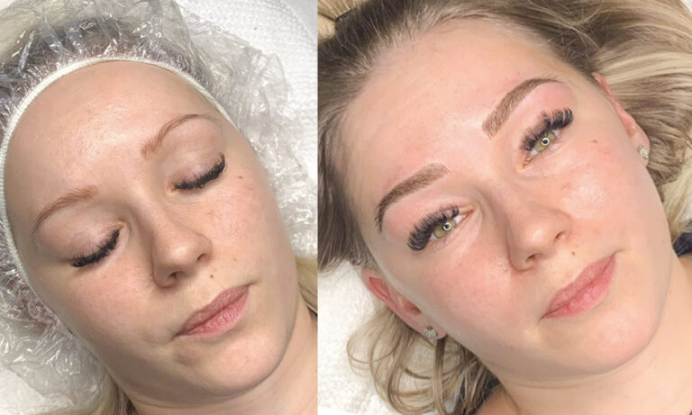 Old orange colored Microblading covered with Combo Brows.